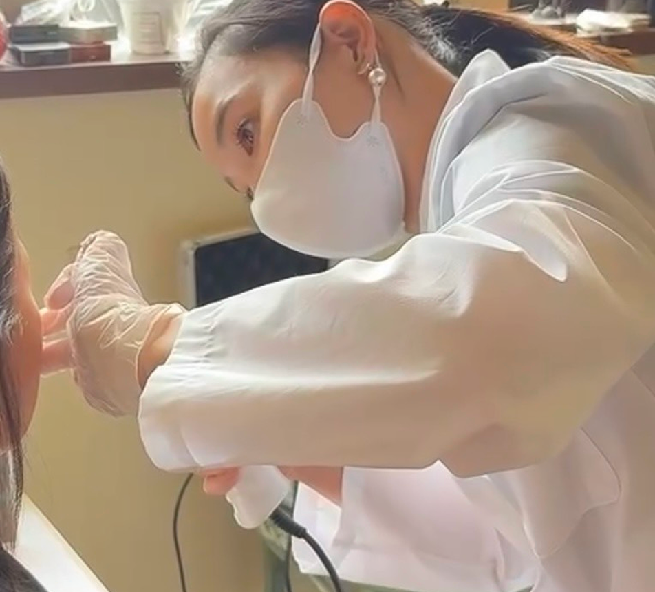 施術している様子